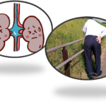 腎の下垂と腰痛について・・・船橋市のオステオパシー整体