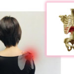 ショックで発生する横隔膜性の肩の痛みについて…千葉県船橋市のオステオパシー整体