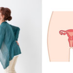 更年期の女性に多い子宮が原因の腰痛について…千葉県船橋市のオステオパシー整体